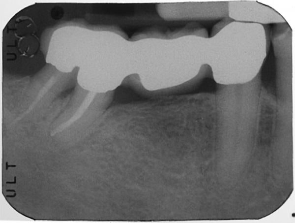 endodonzia