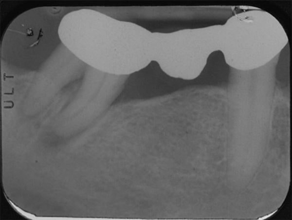 endodonzia