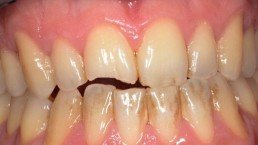 ricostruzioni dentali