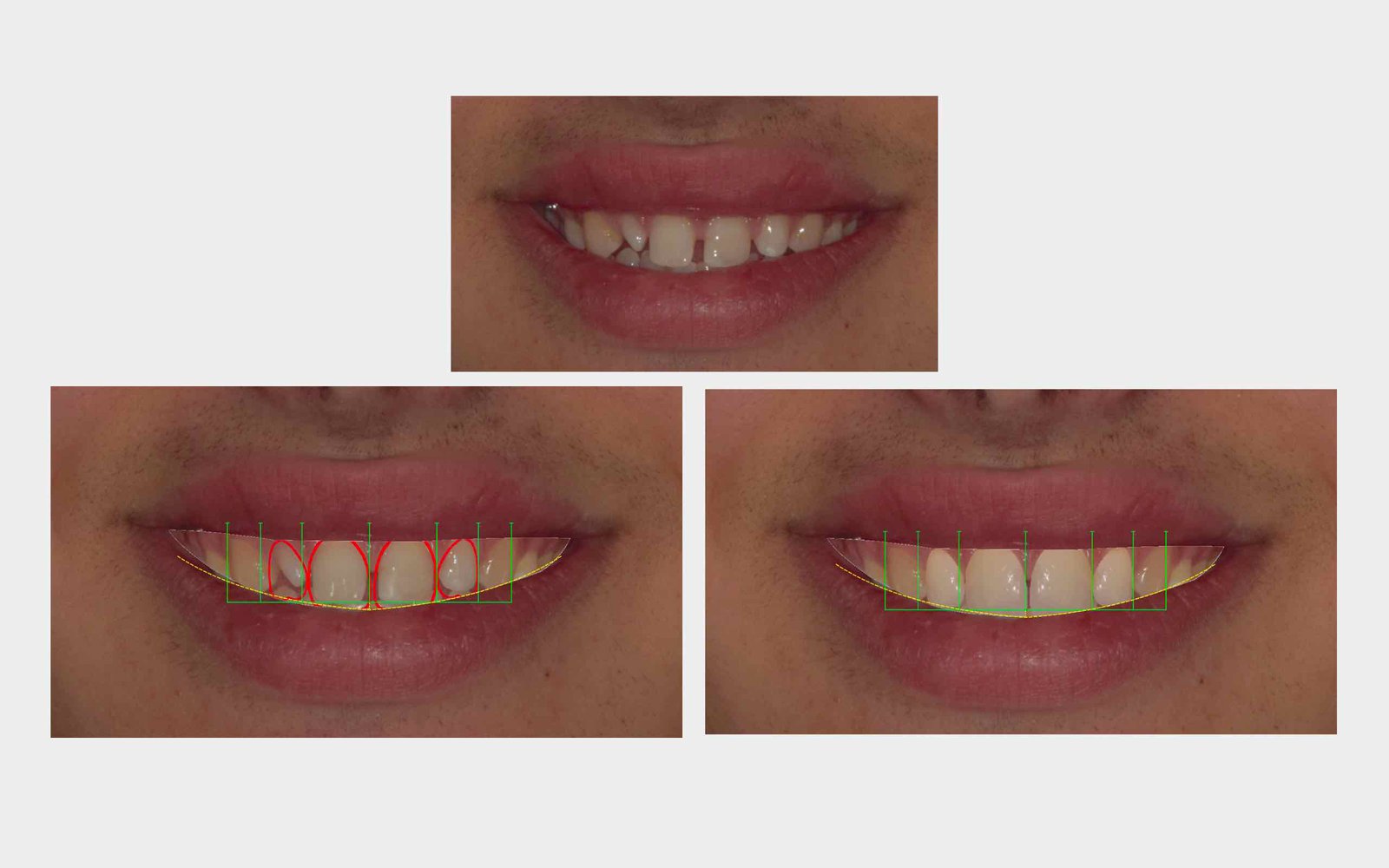 sorriso virtuale